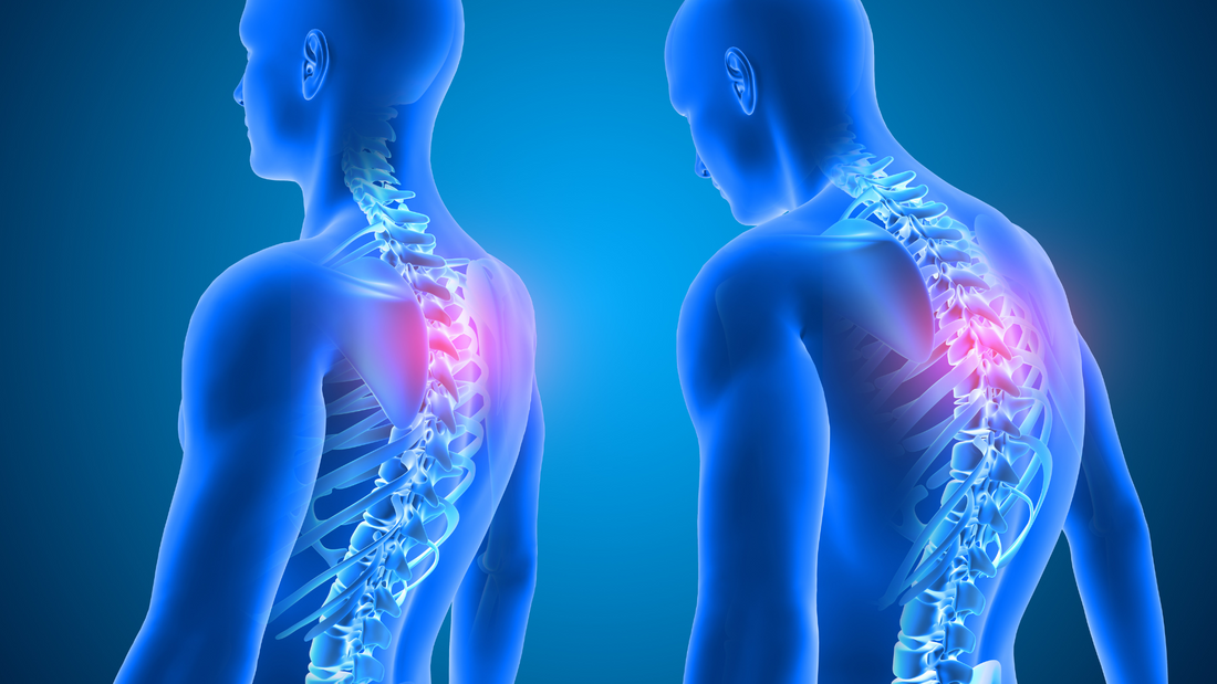 5 solutions pour soulager les douleurs aux genoux causées par une mauvaise posture