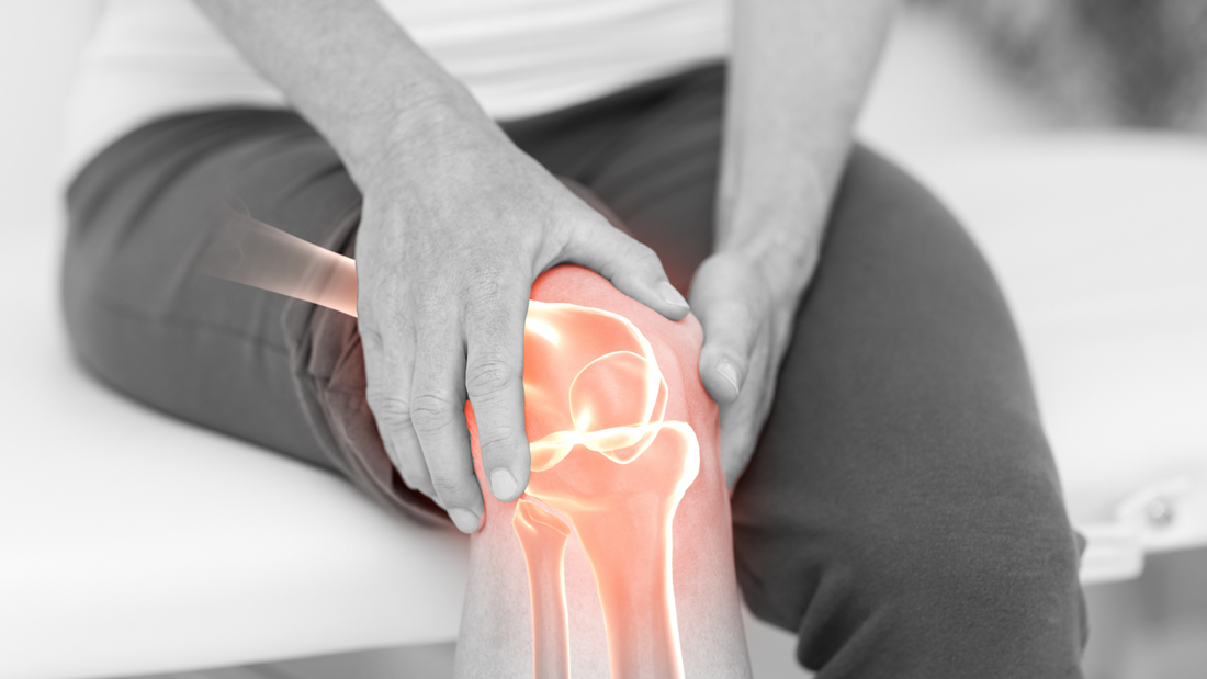 Arthrite du genou : Les 4 traitements possibles pour soulager vos douleurs (+ BONUS : Prévenir l'arthrite)